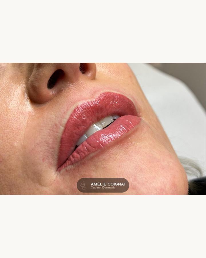 Dermopigmentation rose - Cabinet Dermavie Sainte-Maxime