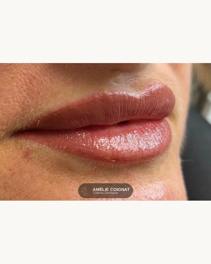 Glossy 1 - Cabinet Dermavie Sainte-Maxime