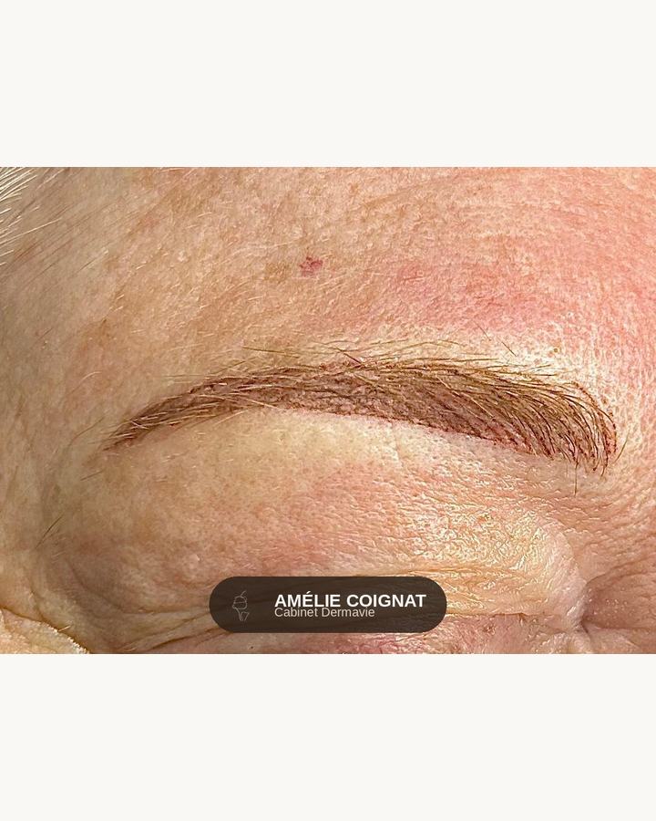 Combo microshading hairstroke - Cabinet Dermavie Sainte-Maxime