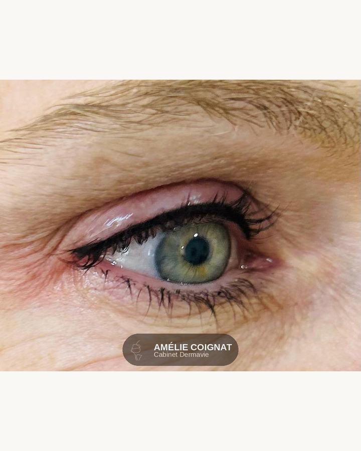 Lashliner densifie - Cabinet Dermavie Sainte-Maxime
