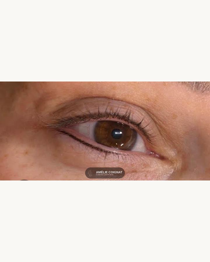 Liner inferieur - Cabinet Dermavie Sainte-Maxime