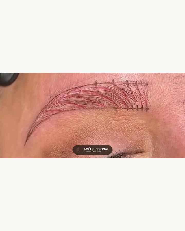 Mapping trace - Cabinet Dermavie Sainte-Maxime