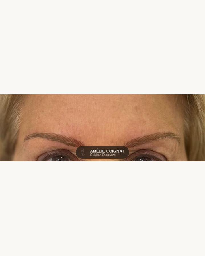 Microblading mature - Cabinet Dermavie Sainte-Maxime
